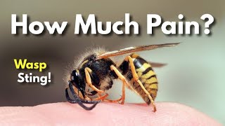 How Dangerous Is A Wasp Sting Explained [upl. by Wistrup28]