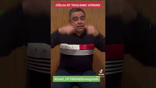 Effects of thalamic stroke [upl. by Diet5]