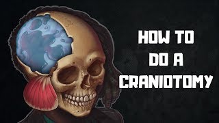 How to do a craniotomy [upl. by Surtemed]