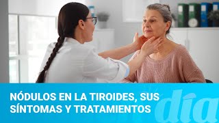 Nódulos en la tiroides sus síntomas y tratamientos [upl. by Ihsir70]