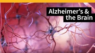 How Alzheimers Changes the Brain [upl. by Hamnet]