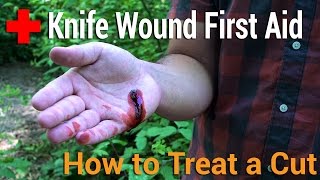 How to Treat a Cut  Knife Wound First Aid [upl. by Katushka]