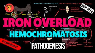 HEMOCHROMATOSIS Pathogenesis Mechanism of clinical symptoms Diagnostic criteria Treatment [upl. by Aicilf644]