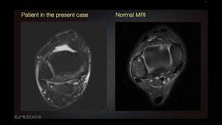 Sports Medicine Case 2 22yearold An Awkward Ankle Injury [upl. by Carver]