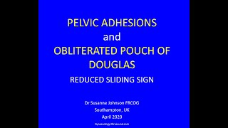 PELVIC ADHESIONS AND FROZEN PELVIS [upl. by Toby]