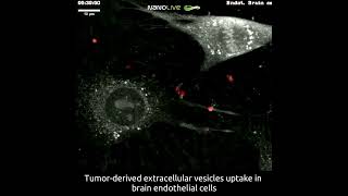 Tumorderived extracellular vesicles uptake in mouse brain endothelial cells [upl. by Wilona341]