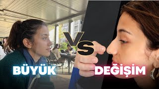 Burun Estetiği Vlog  Büyük Değişim [upl. by Anayt]