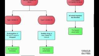 Arrhythmias Flowchart USMLE Step 2 CK [upl. by Aneehsyt]