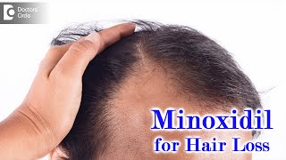 Right way to use MINOXIDIL SOLUTION for HAIR LOSSEXPERT ADVICEDrDeepak P Devakar Doctors Circle [upl. by Luanni]