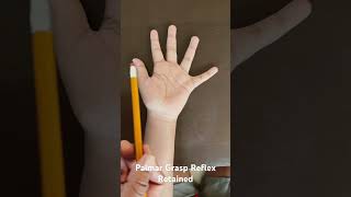 Primitive Reflexes Palmar Grasp Reflex Retained [upl. by Nagel]