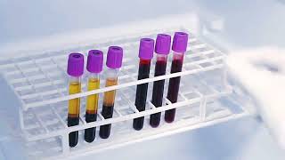 HbA1c Test ProcedureDemonstrationBlood SampleALERE ABBOTT [upl. by Aida]