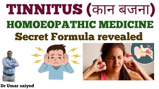 TINNITUS HOMOEOPATHIC MEDICINE SECRET FORMULA [upl. by Luella]