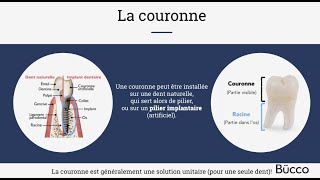 Les prothèses dentaires  TV de Salle dattente Dentiste [upl. by Ahtamat]