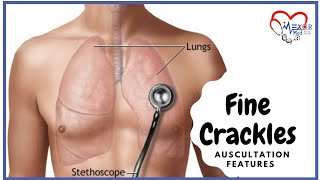 Fine Crackles  Lung Sounds  Auscultation Features [upl. by Tad]