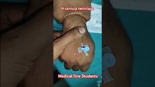 IV cannula technique IV cannula kaise lagate hain hospital viralvideo viralshort shorts [upl. by Aikcir719]