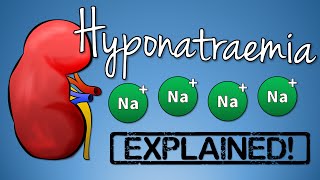 Hyponatremia EXPLAINED with Animation [upl. by Yedarb793]