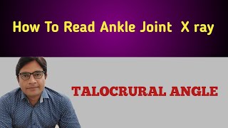 How To Measure TALOCRURAL ANGLE On Ankle X ray [upl. by Ikoek115]