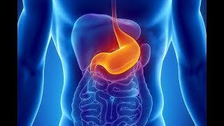 What is Dyspepsia What causes Dyspepsia Symptoms and Treatment of Indigestion [upl. by Rebmyt]