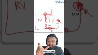 Approach to EKG for the USMLE  HyGuru [upl. by Latty]