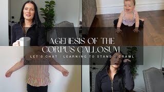 Agenesis of the Corpus Callosum  Let’s Chat  Learning to Stand  crawl [upl. by Araccot420]