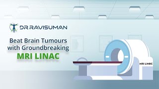 Introducing the Latest Technology for Treating Brain Tumor The MRI LINAC [upl. by Shih]