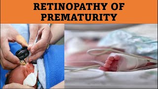 What Causes ROP  Retinopathy of prematurity [upl. by Ayomat]