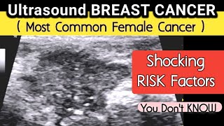 Breast Mass  Cancer  Ultrasound  Shocking Risk Factors You Donquott Know [upl. by Ayalahs]