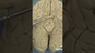 Uncus of parahippocampal gyrus neuroanatomy limbicsystem cortex forebrainmedicaleducation [upl. by Reywas]