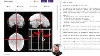 Exploring Open Source Brain MRI Data with Python  Building a 3D MRI Viewer Using Flask [upl. by Bj]