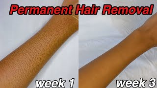 Permanent Hair Removal Method  I tried at home laser hair removal for 3 weeks [upl. by Brear]