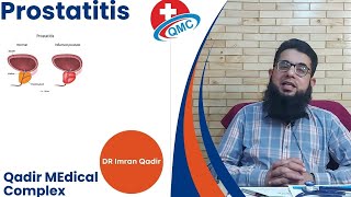 Prostatitis  Dr imran Qadir [upl. by Giliana713]