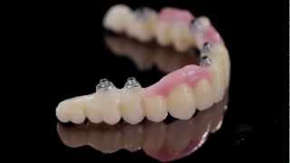 K Dental LabZirkonzahn PrettauImplant screwretained bridge1mov [upl. by Noskcaj332]