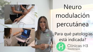 Neuromodulación percutánea ecoguiada 💹 ¿Para quién sirve 💹Clinicas H3 Madrid [upl. by Gemmell799]