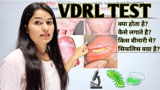 VDRL Test  VDRL Test in hindi  Venereal disease research laboratory  Microbiology [upl. by Coshow707]