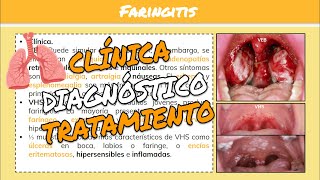 ⚕️🩺FARINGITISFARINGOAMIGDALITIS y HERPANGINA SíntomasTratamiento [upl. by Aicinat]