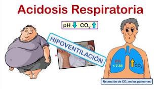 INTERPRETACIÓN DE LA GASOMETRÍA EN 4 PASOS 💉💉 con EJERCICIOS de PRÁCTICA al final del video [upl. by Pump]