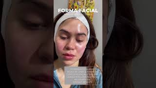 Forma Facial at Skin Tightening Botox and Lip Fillers by Skinsation LA in Los Angeles CA [upl. by Licec328]