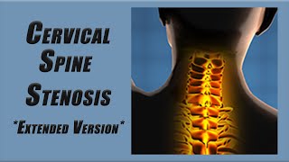 Best Exercises for Stenosis in the Cervical Spine  Slower Pace and More Reps [upl. by Zetra]