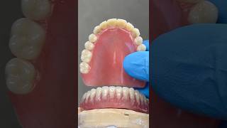 Upper Process and Lower Locator Hybrid Denture lsk121shorts dentist teeth [upl. by Auohs]