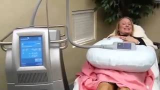 A Demonstration of CoolSculpt with Dr Jennifer Pennoyer [upl. by Arakihc180]