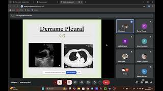 Derrame pleural Dr Jojot [upl. by Carlene]