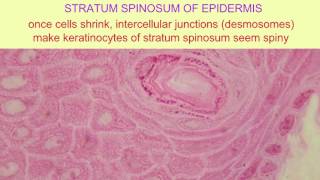 DESMOSOMES IN STRATUM SPINOSUM [upl. by Jervis]