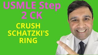 USMLE Step 2 CK score 270 series  Schatzkis ring [upl. by Miquela630]