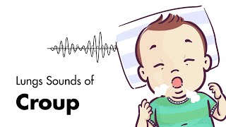 Sounds of Croup Laryngotracheitis  Lung Sounds  MEDZCOOL [upl. by Yasnyl]