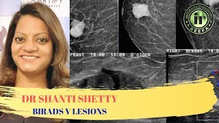 TMT BIRADS V Lesions by Dr Shanti Shetty [upl. by Roth657]