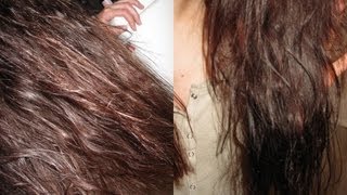 ✿⊱╮Cheveux gras  solutions naturelles [upl. by Conias86]