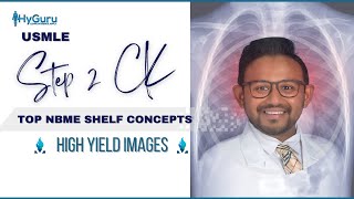 Top NBME Images Radiology  USMLE Step 2 CK 🩻 [upl. by Estis99]