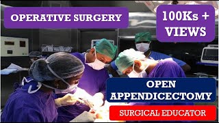 OPEN APPENDECTOMY STEP BY STEP OPERATIVE SURGERY [upl. by Aytnahs720]