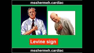 Levine sign [upl. by Oniger]