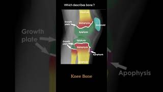 Bone Anatomy knee example 1 Musculoskeletal Xray  General principles radiologychannel007 [upl. by Atirihs]